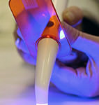 Highlights fra rapporten  «Testing av dentale materialer»